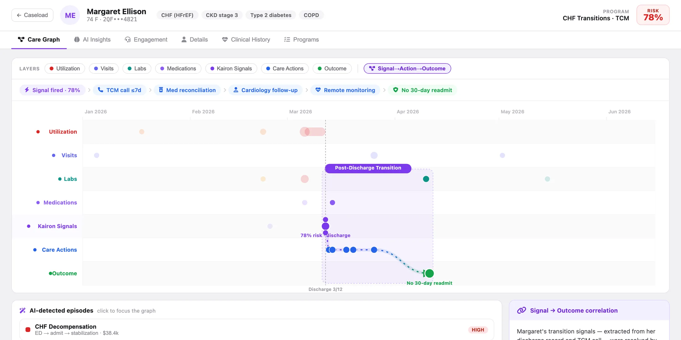 Patient care graph tracing a hospital discharge through a TCM call and follow-up actions to no readmission at 30 days